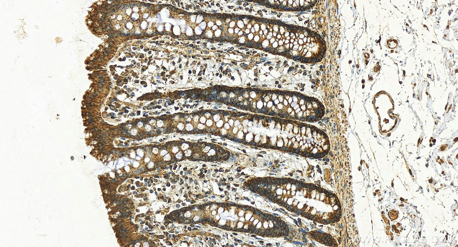 IHC staining of human colon using 15462-1-AP