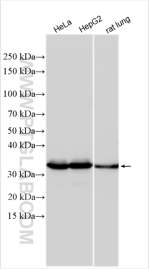 WB analysis using 15462-1-AP