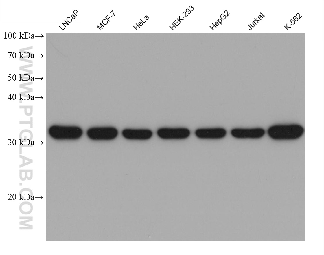 WB analysis using 68878-1-Ig (same clone as 68878-1-PBS)