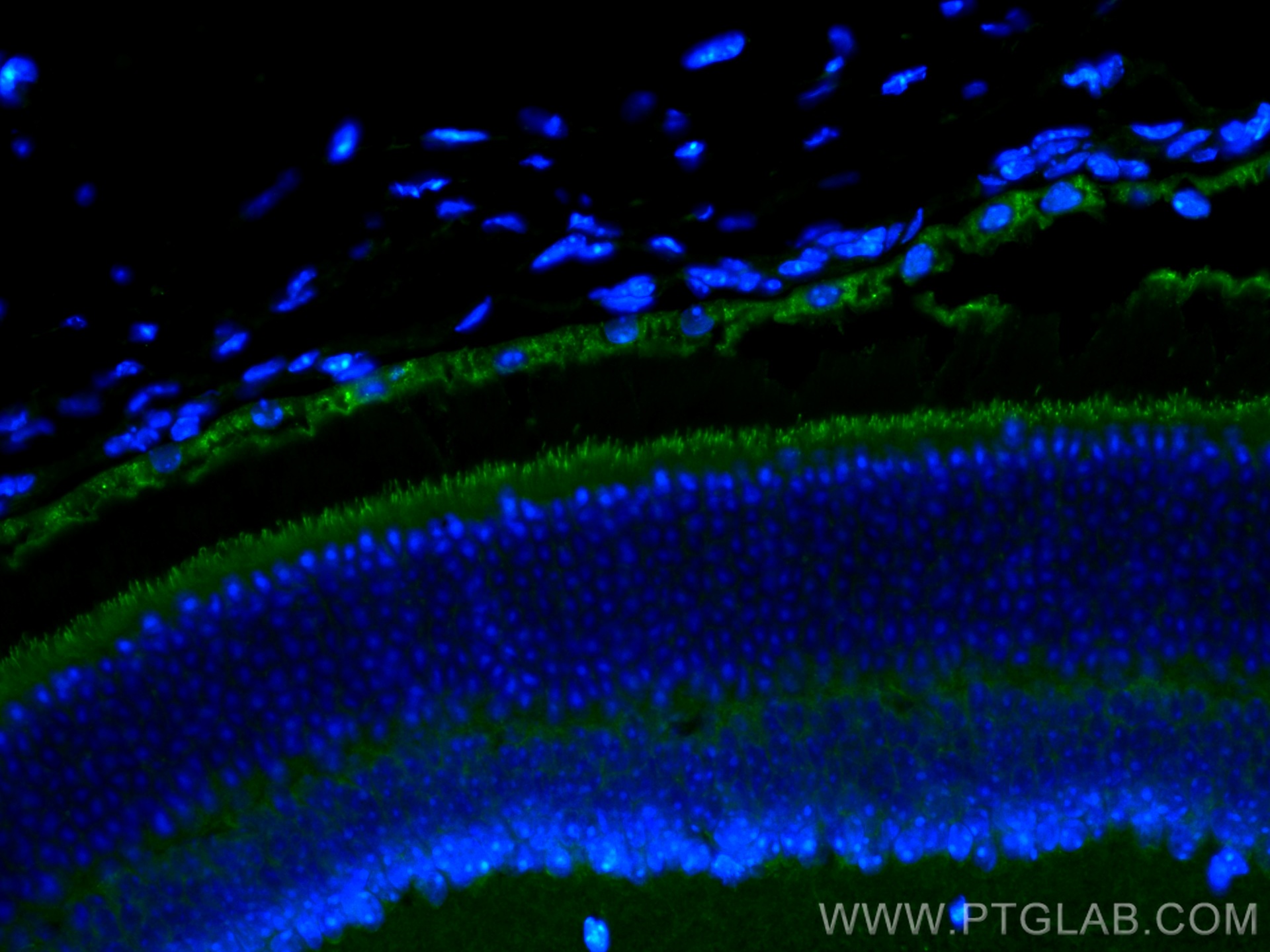 IF Staining of mouse eye using 17575-1-AP