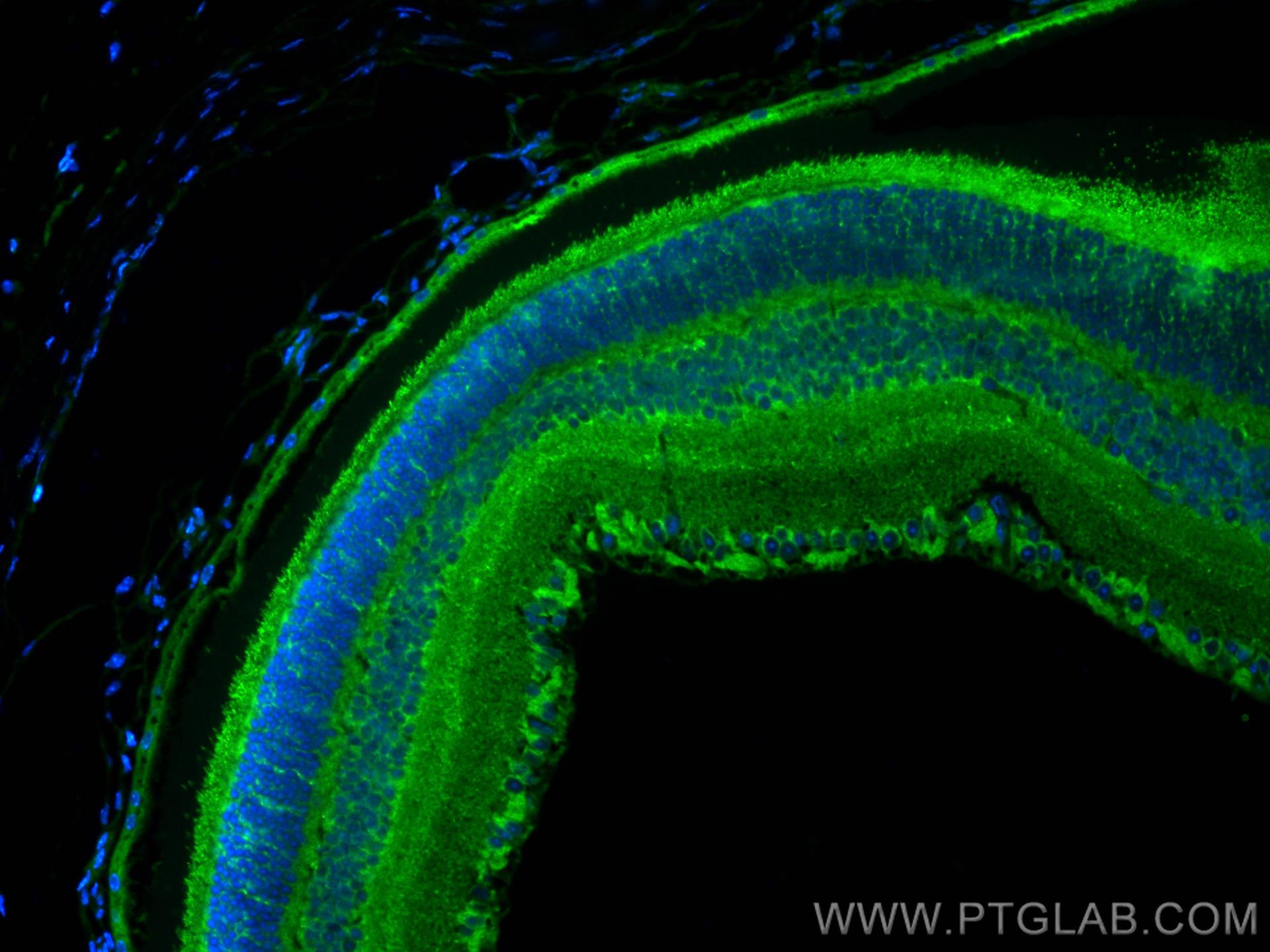 IF Staining of mouse eye using 17575-1-AP