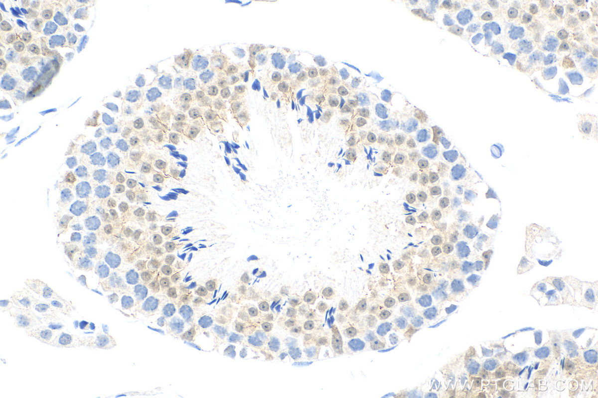 IHC staining of mouse testis using 83141-2-RR (same clone as 83141-2-PBS)