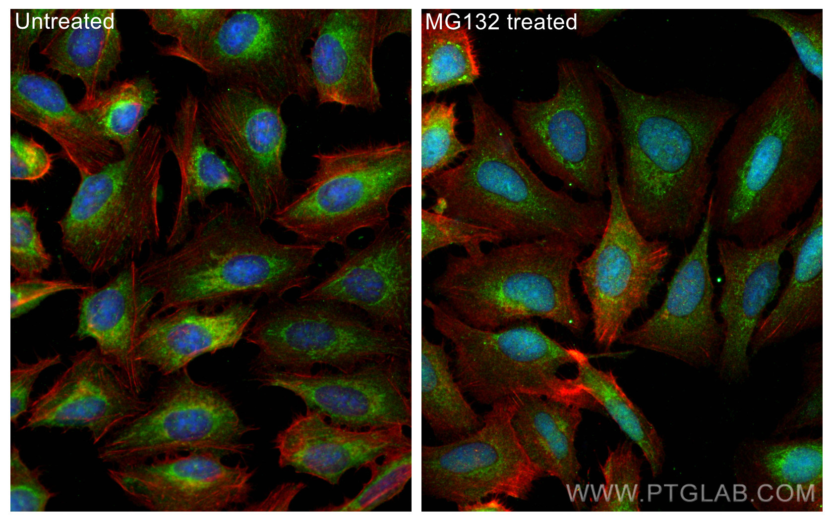 IF Staining of U2OS using 27883-1-AP