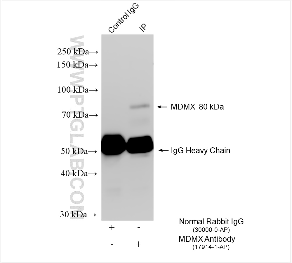 IP experiment of HeLa using 17914-1-AP