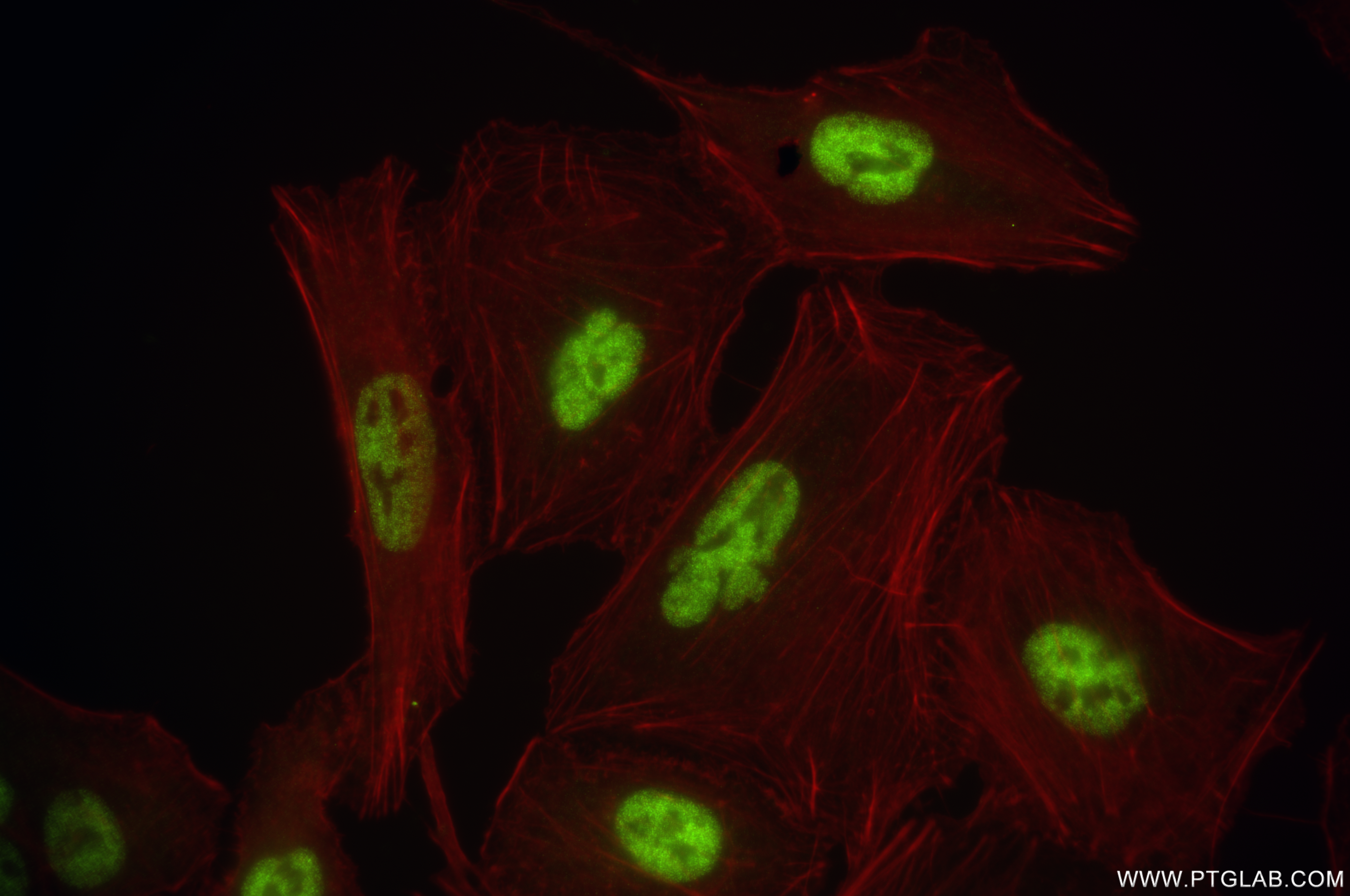 IF Staining of A549 using 84534-6-RR