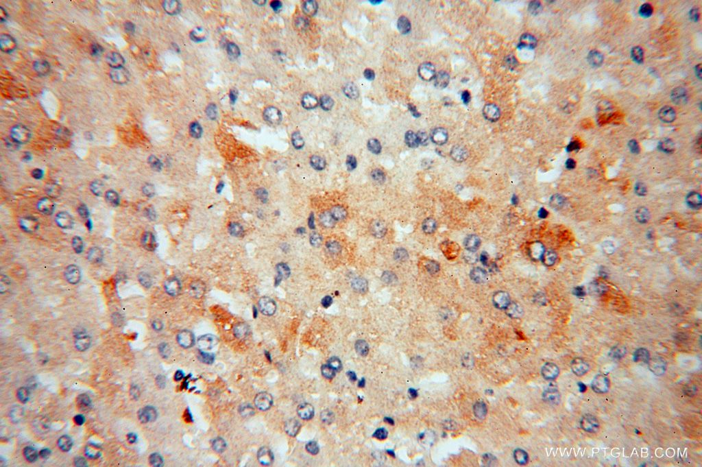 IHC staining of human liver using 16619-1-AP