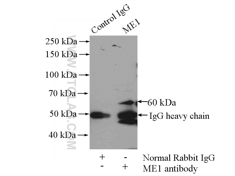 IP experiment of mouse liver using 16619-1-AP