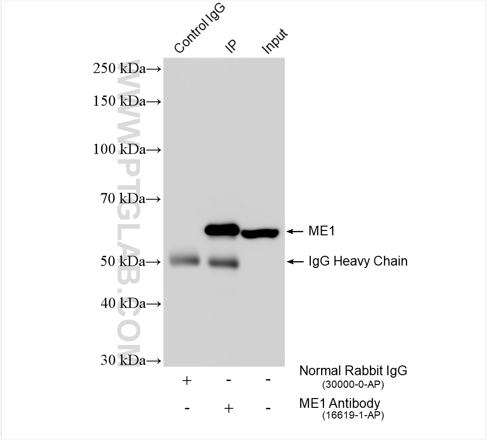 IP experiment of mouse liver using 16619-1-AP