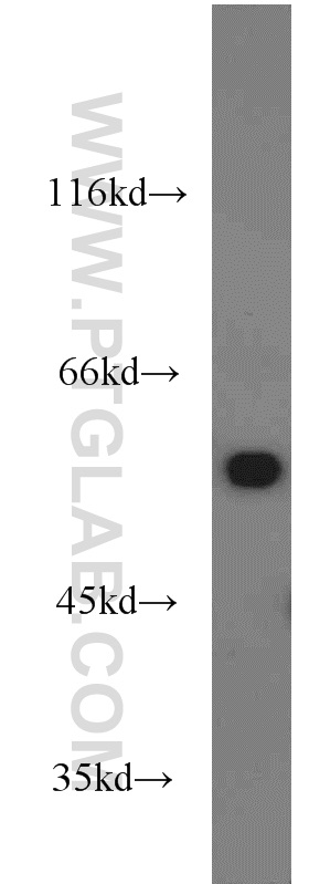 WB analysis of mouse liver using 16619-1-AP