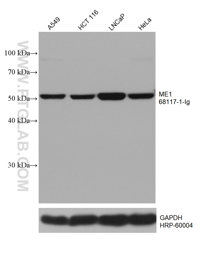 WB analysis using 68117-1-Ig