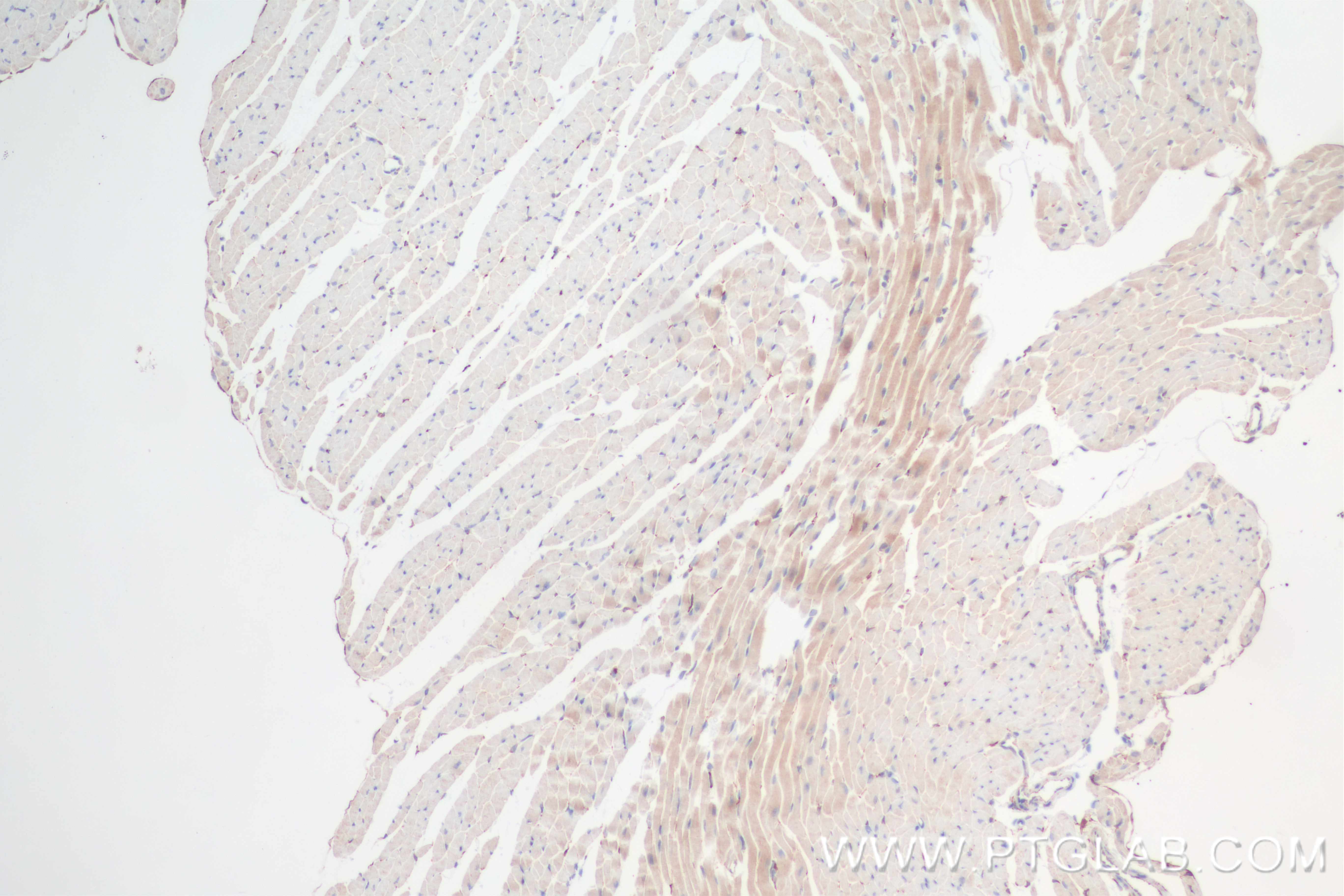 IHC staining of mouse heart using 84729-4-RR