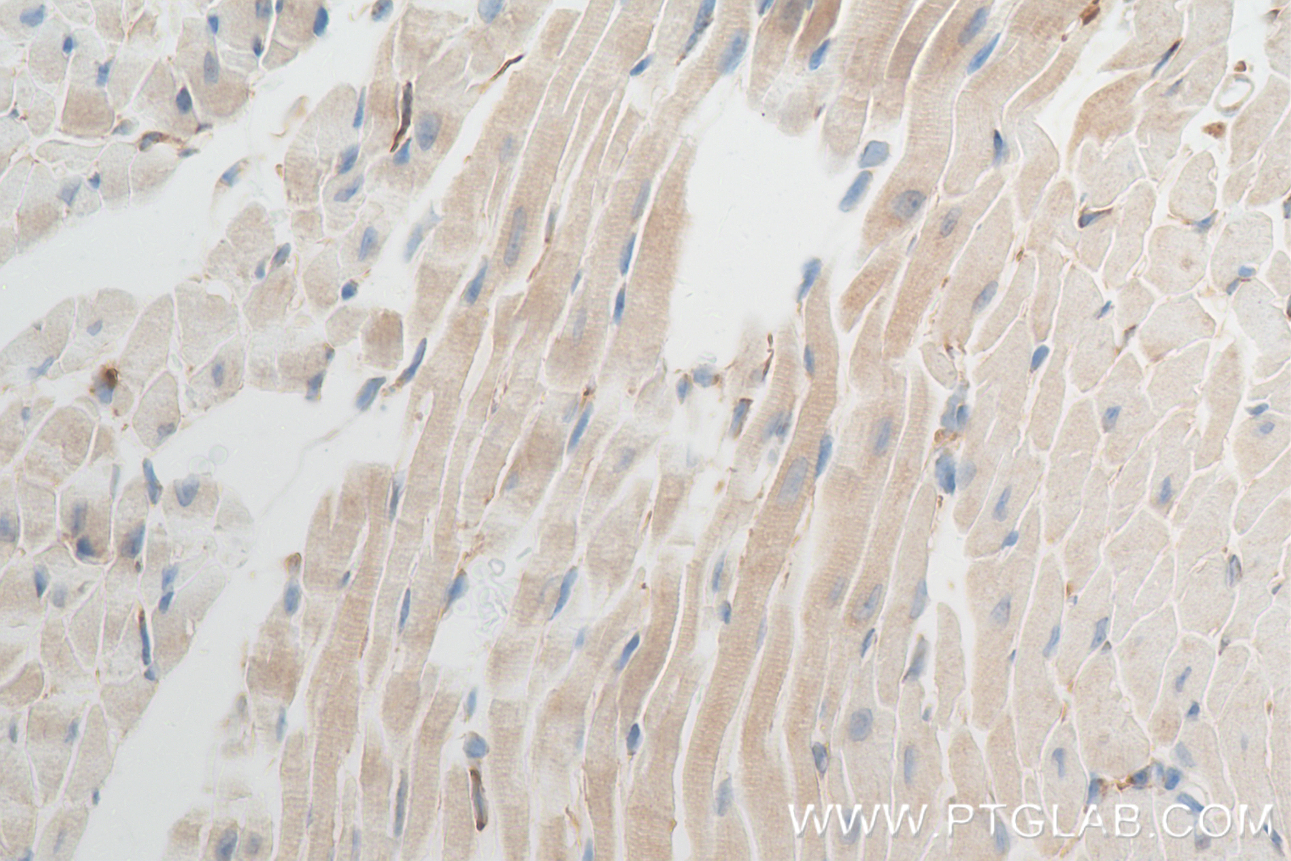 IHC staining of mouse heart using 84729-4-RR