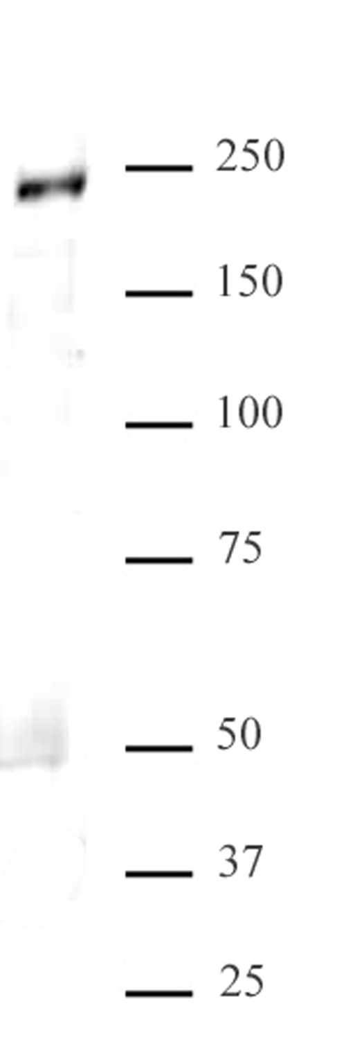 MED1 antibody (pAb) tested by Western blot. Nuclear extract (30 ug) of HeLa cells probed with MED1 antibody at a dilution of 1:2,000.