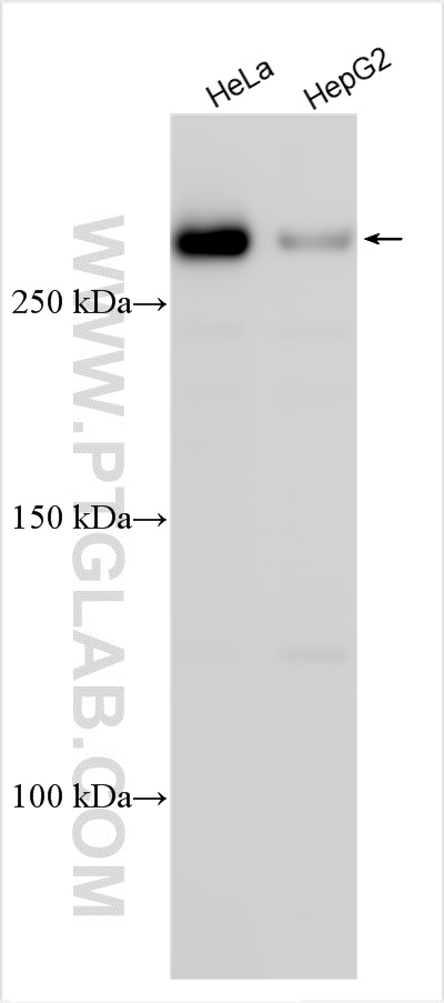 WB analysis using 31041-1-AP