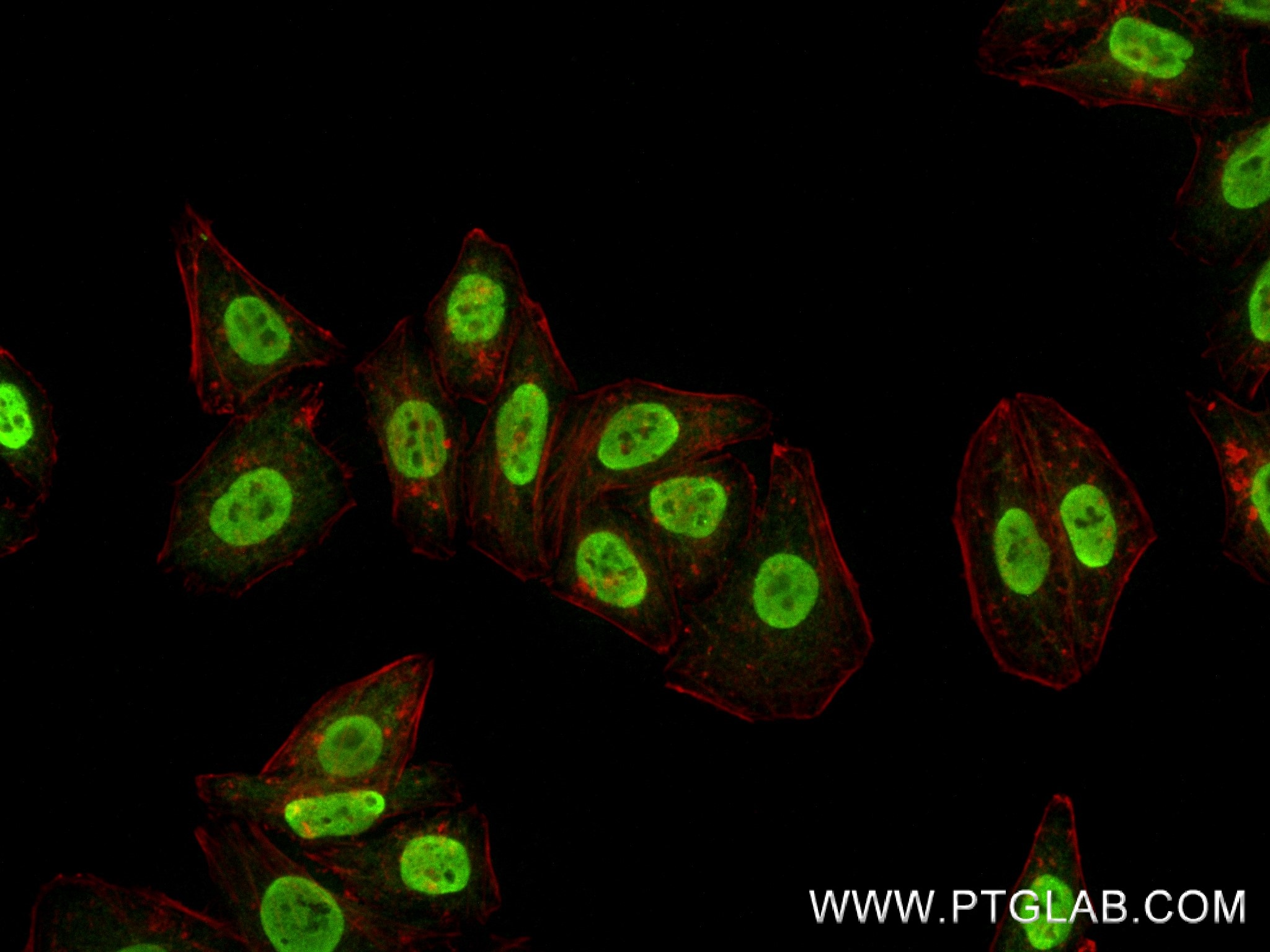 IF Staining of HepG2 using 83540-1-RR