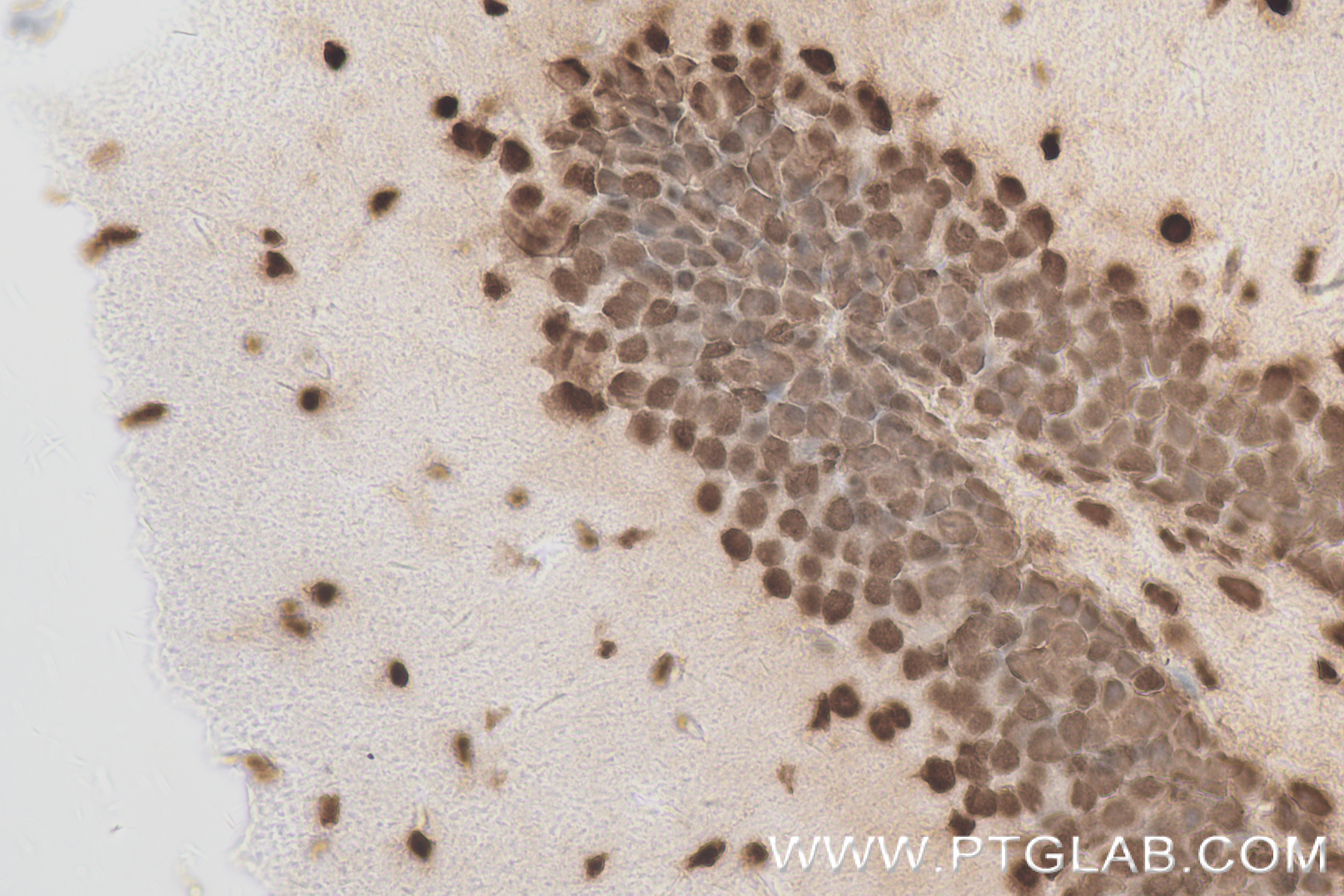 IHC staining of mouse brain using 83540-1-RR