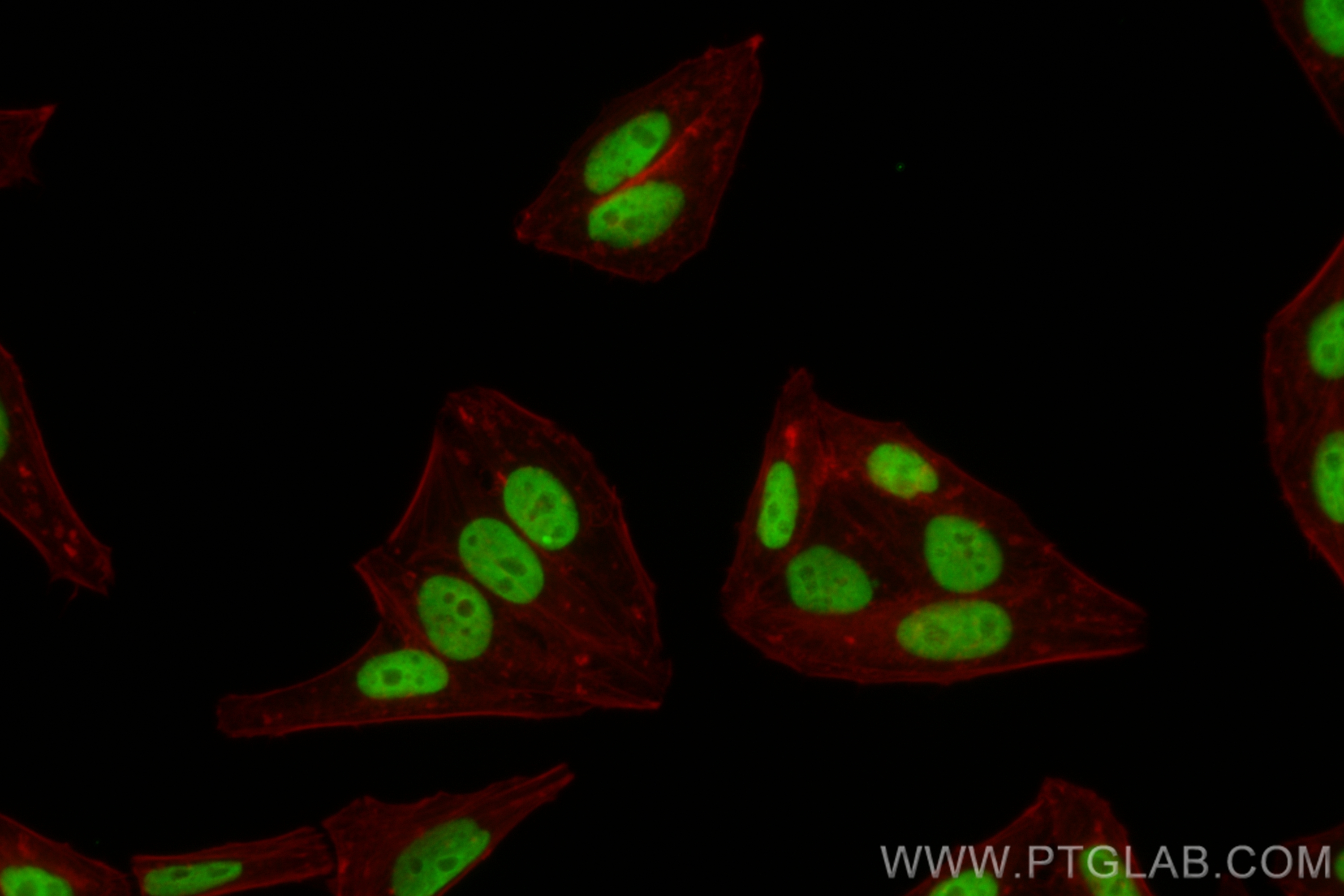 IF Staining of HepG2 using CL488-83540