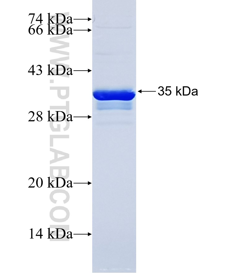 MED12L fusion protein Ag34636 SDS-PAGE