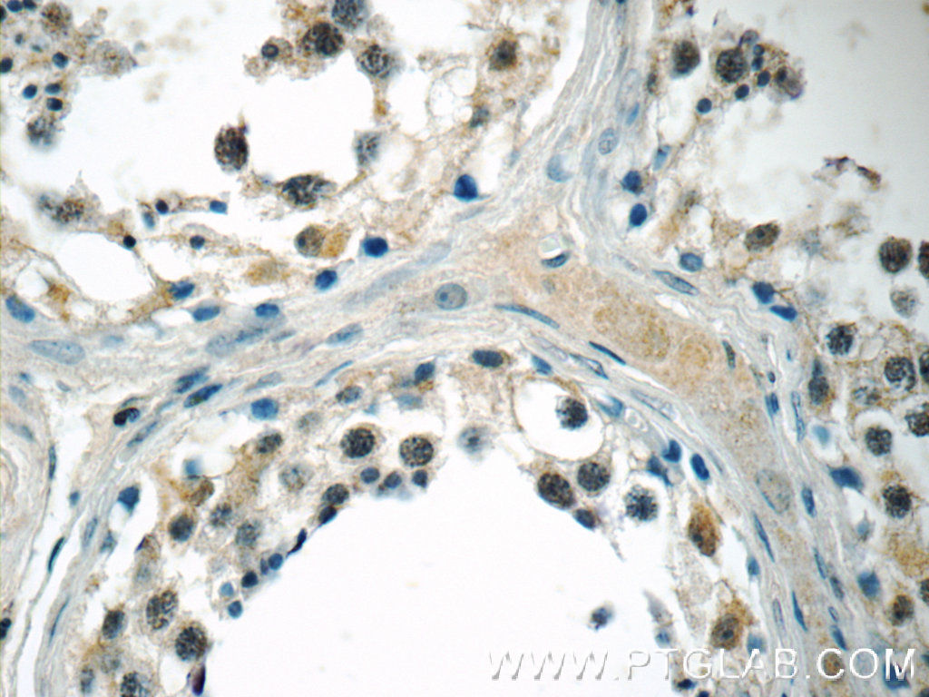 IHC staining of human testis using 13418-1-AP