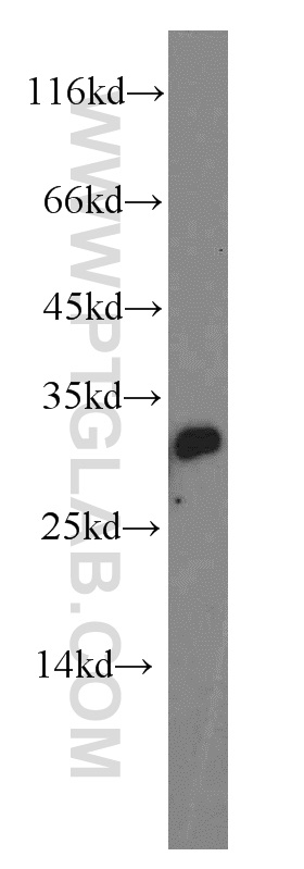 WB analysis of human testis using 13418-1-AP