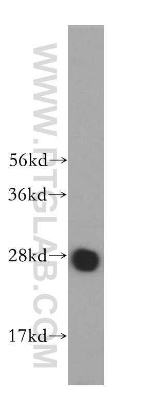 WB analysis of K-562 using 17598-1-AP