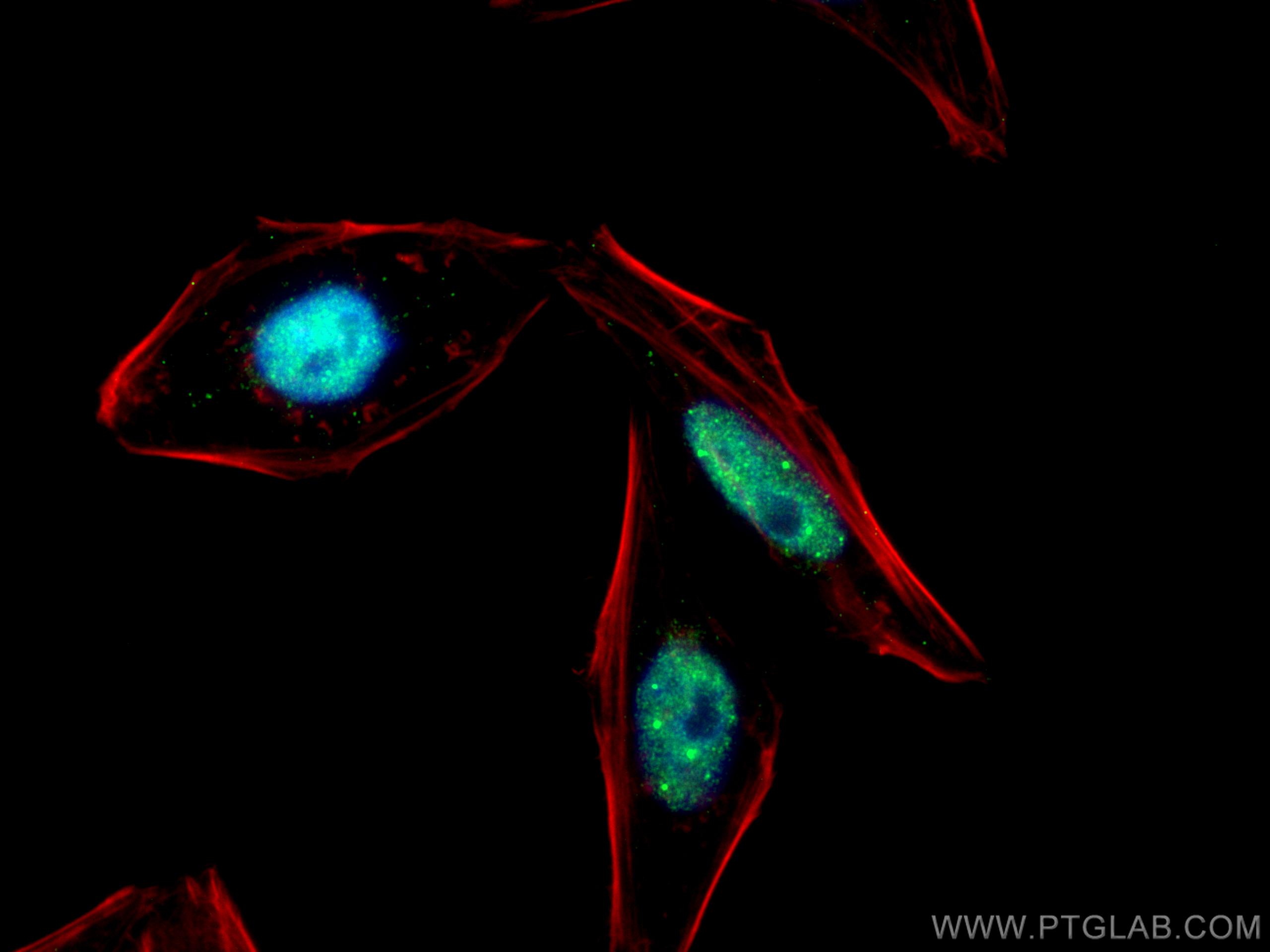 IF Staining of HepG2 using 67839-1-Ig (same clone as 67839-1-PBS)