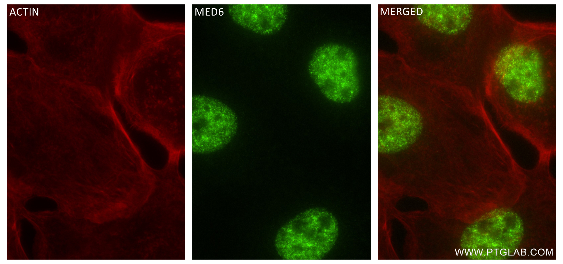 IF Staining of A431 using 84184-5-RR