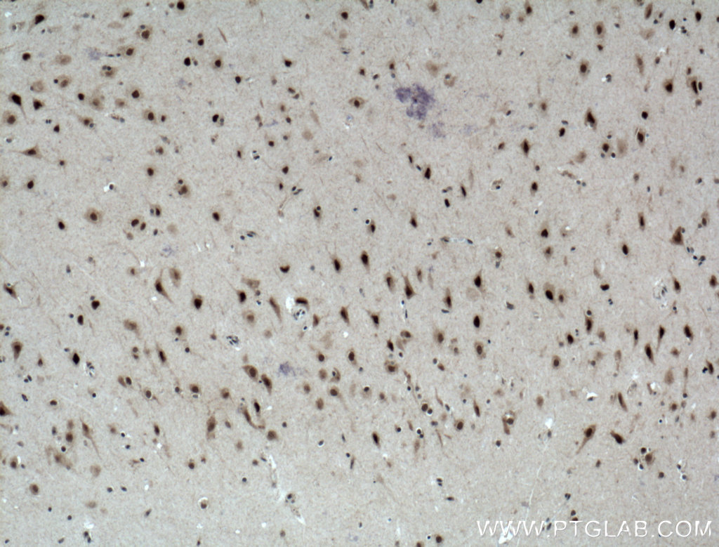 IHC staining of human brain using 12182-1-AP