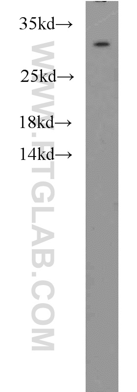 WB analysis of HepG2 using 12182-1-AP