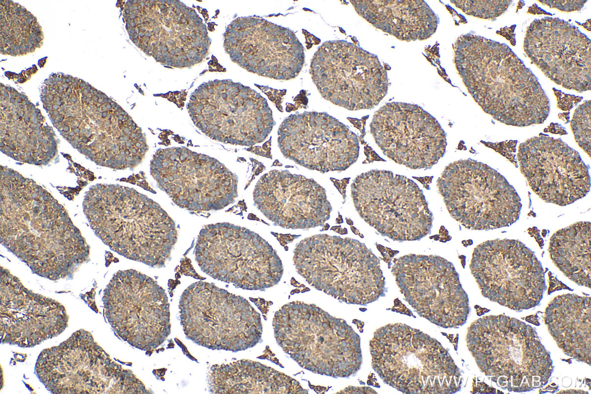 IHC staining of mouse testis using 29892-1-AP