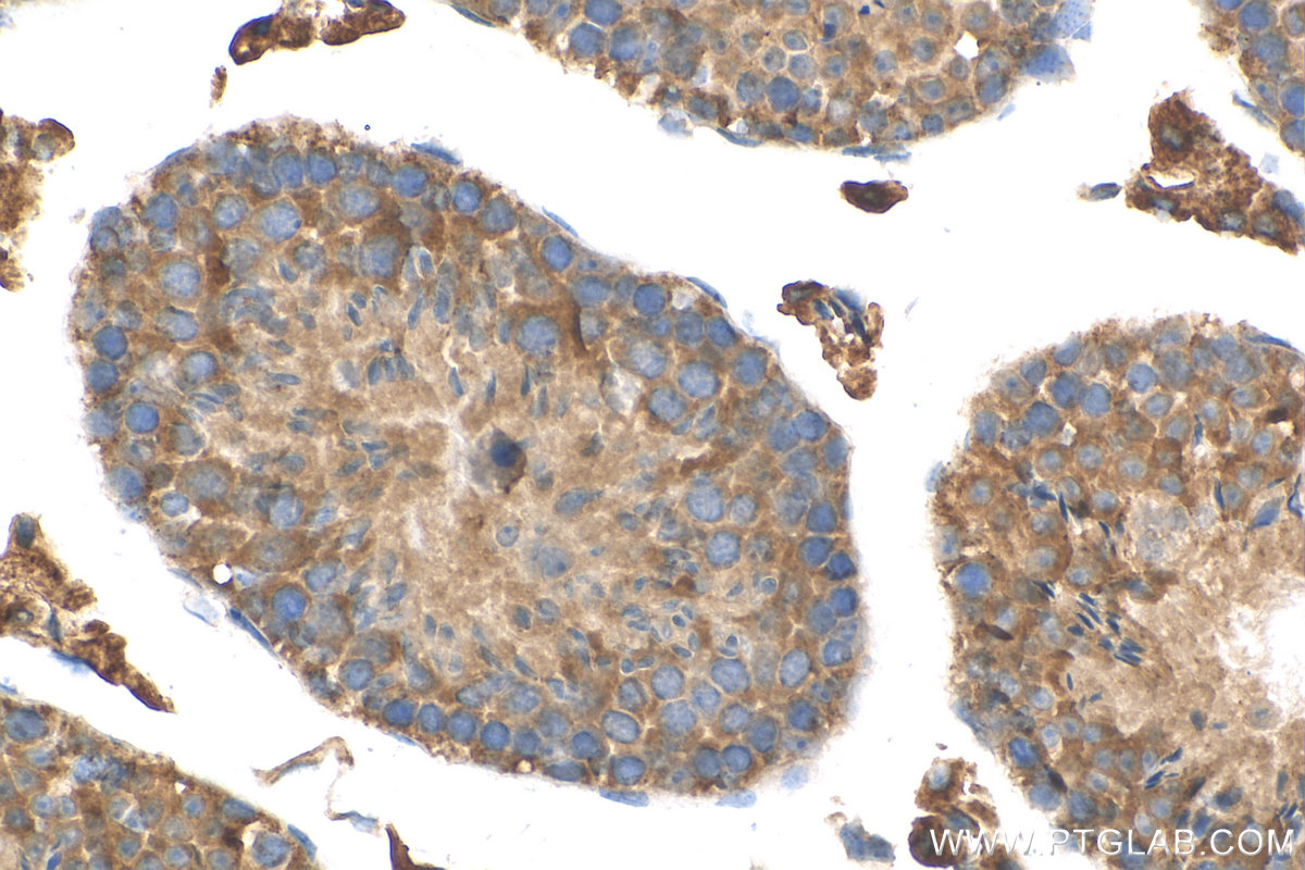 IHC staining of mouse testis using 29892-1-AP