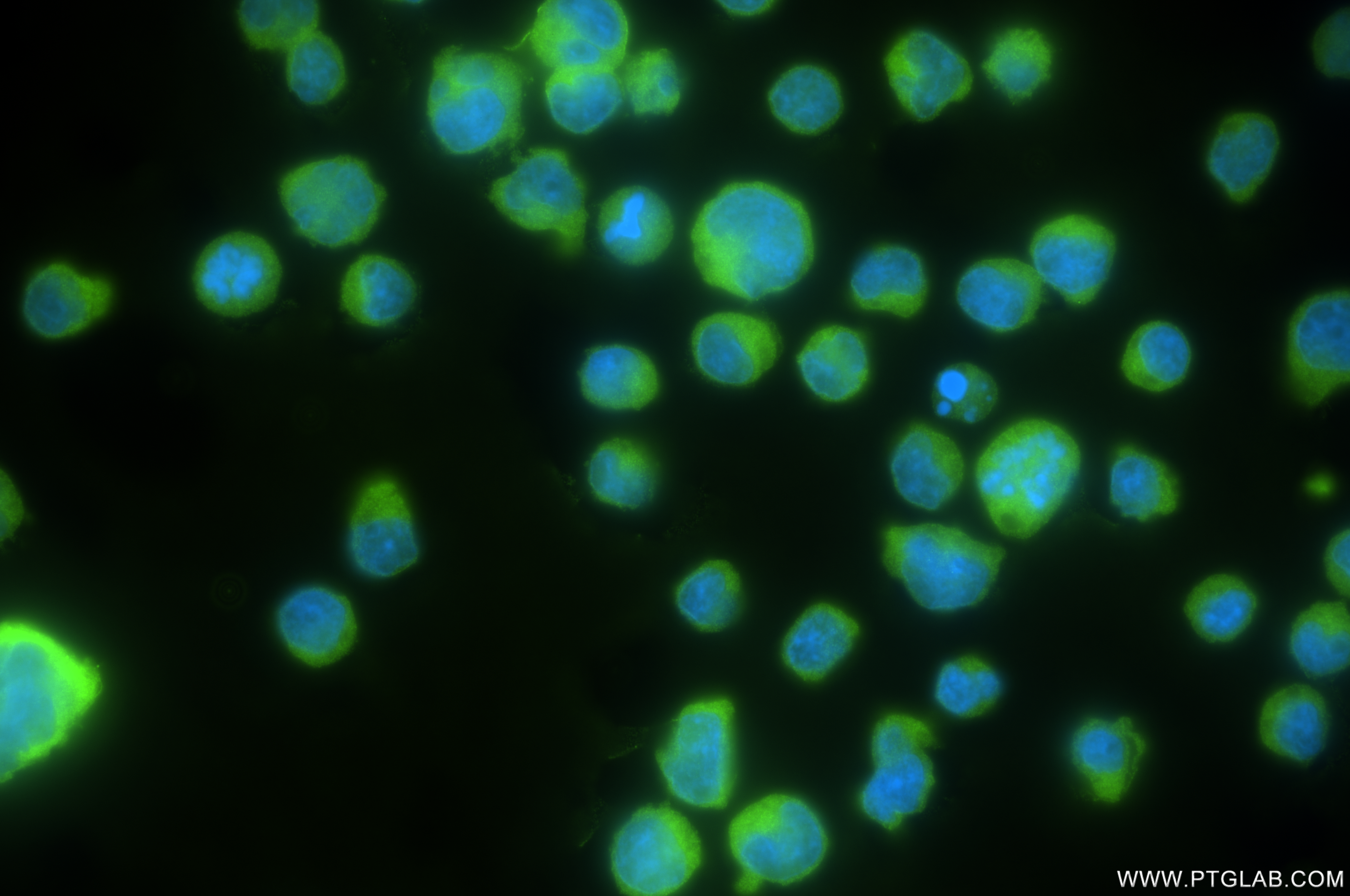 IF Staining of Jurkat using 84967-1-RR (same clone as 84967-1-PBS)