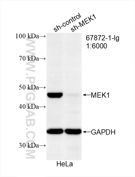 WB analysis of HeLa using 67872-1-Ig