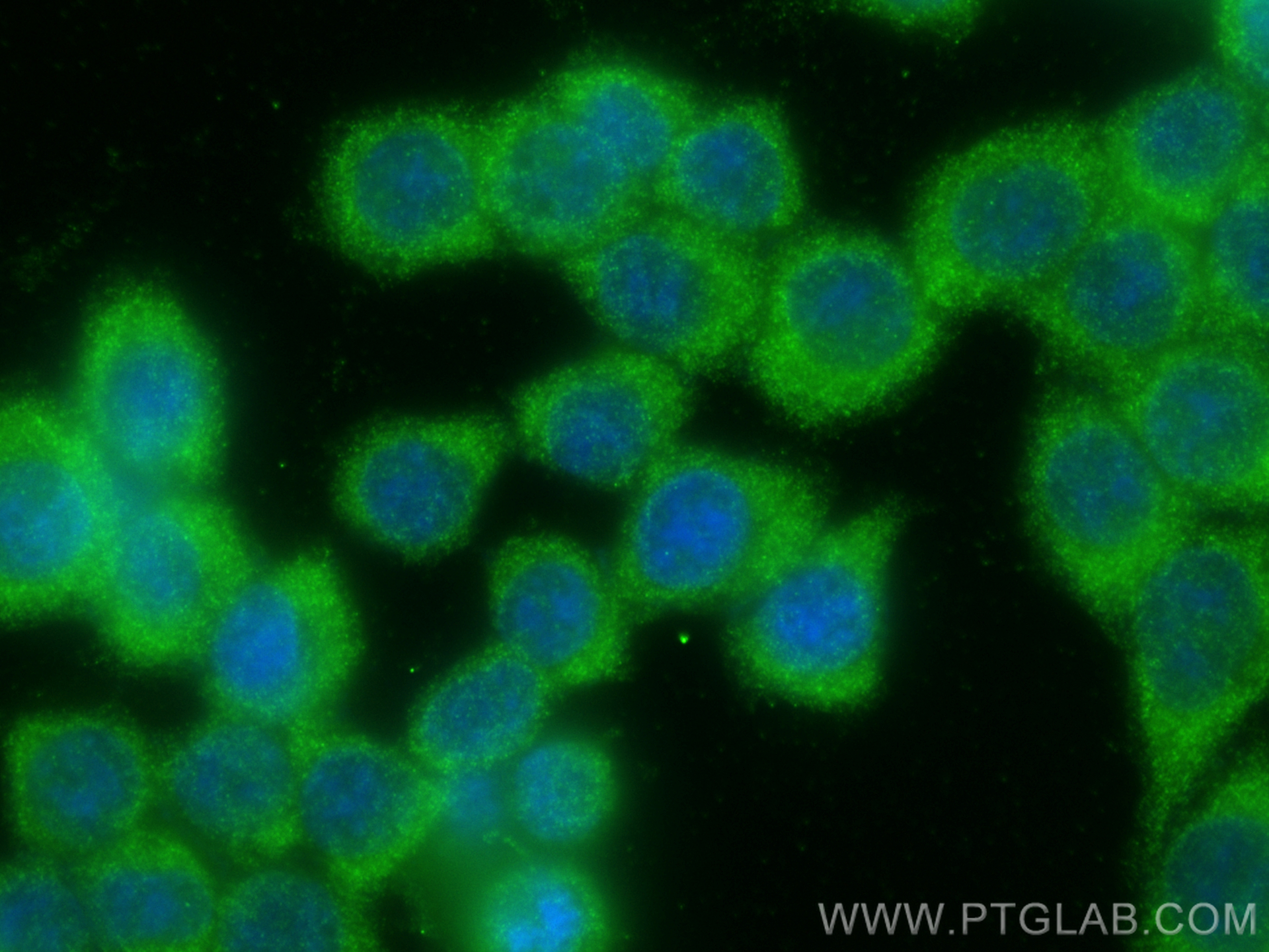 IF Staining of BxPC-3 using 14604-1-AP