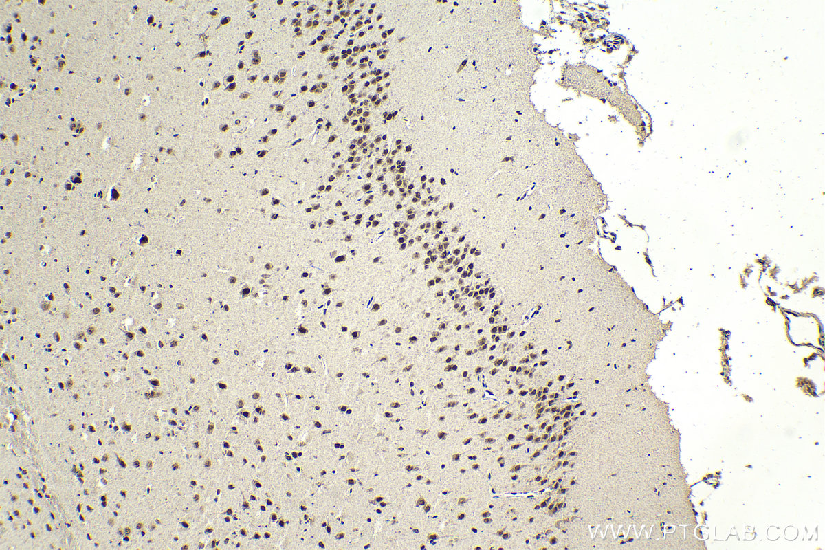 IHC staining of mouse brain using 68473-1-Ig