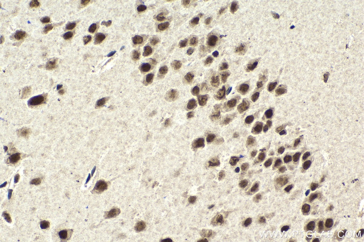 IHC staining of mouse brain using 68473-1-Ig (same clone as 68473-1-PBS)