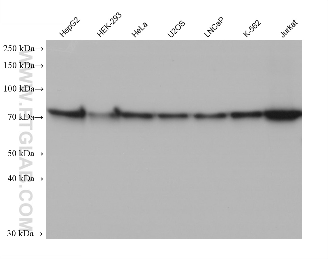 WB analysis using 68473-1-Ig (same clone as 68473-1-PBS)