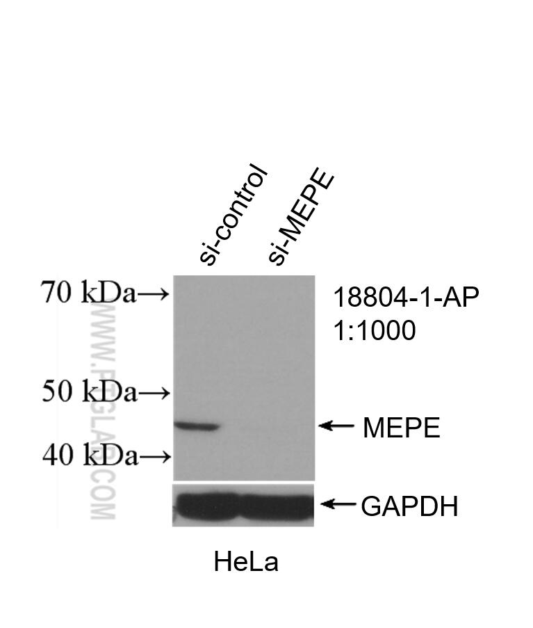 WB analysis of HeLa using 18804-1-AP (same clone as 18804-1-PBS)