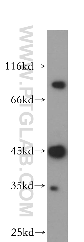 WB analysis of HepG2 using 18804-1-AP (same clone as 18804-1-PBS)