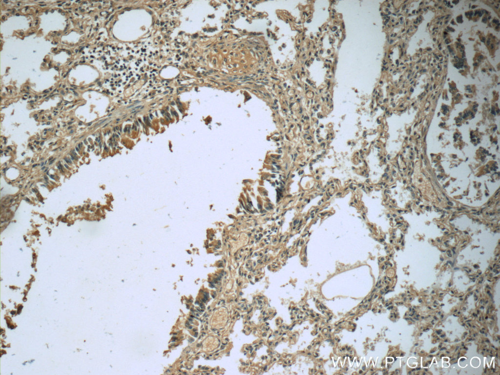 IHC staining of human lung using 23256-1-AP