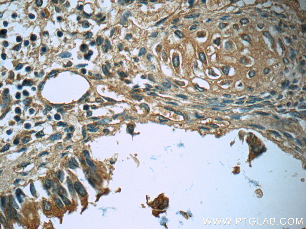 IHC staining of human lung using 23256-1-AP