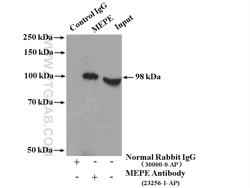 IP experiment of HeLa using 23256-1-AP