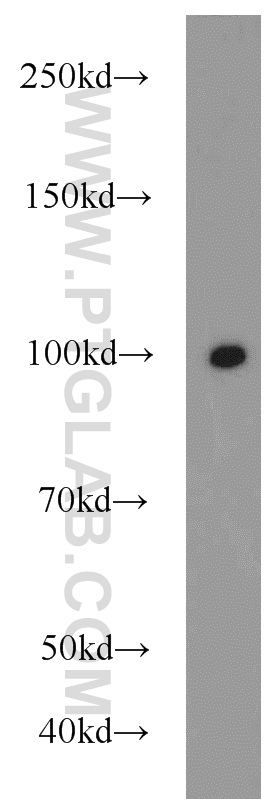 WB analysis of HeLa using 23256-1-AP