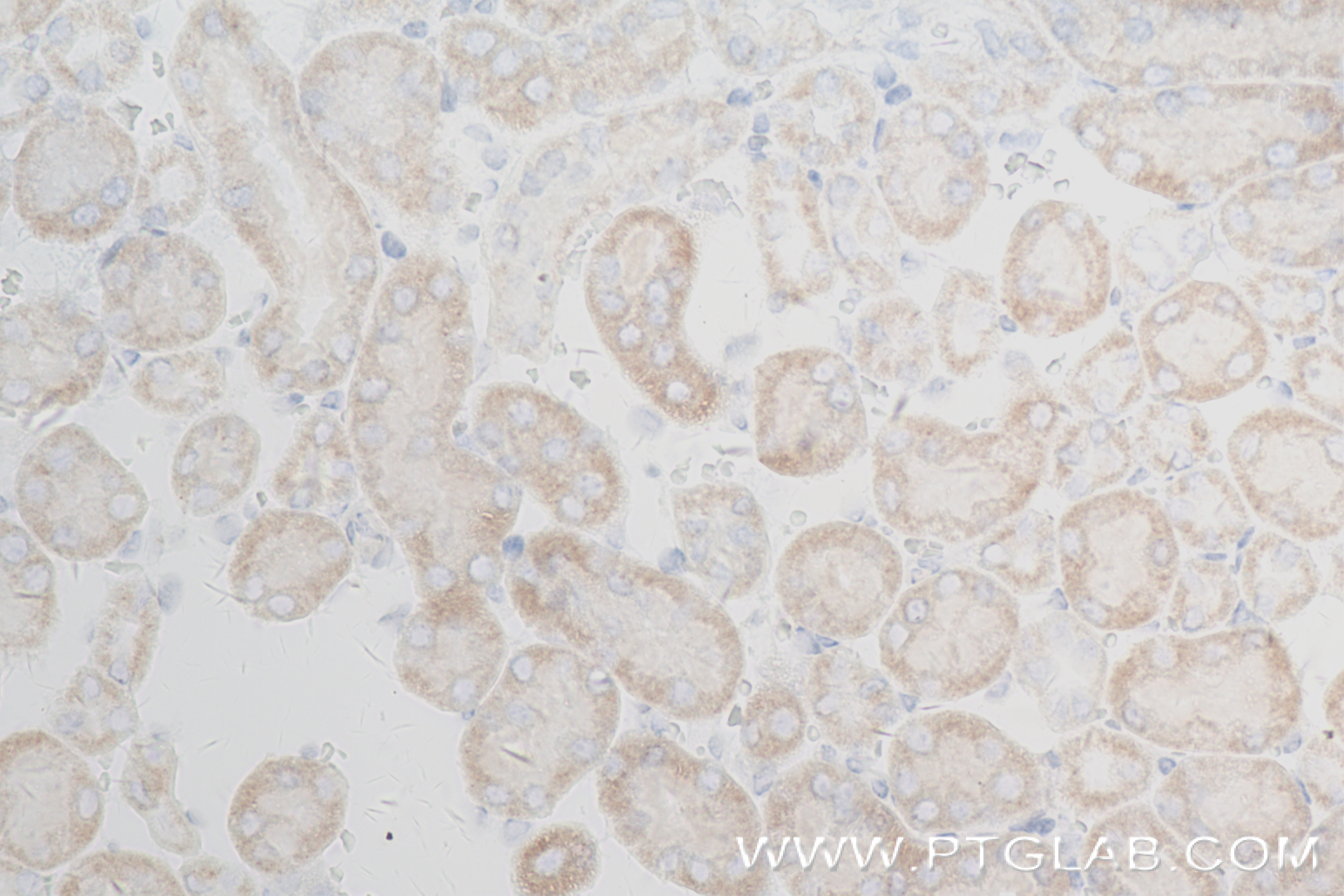 IHC staining of mouse kidney using 84156-2-RR (same clone as 84156-2-PBS)