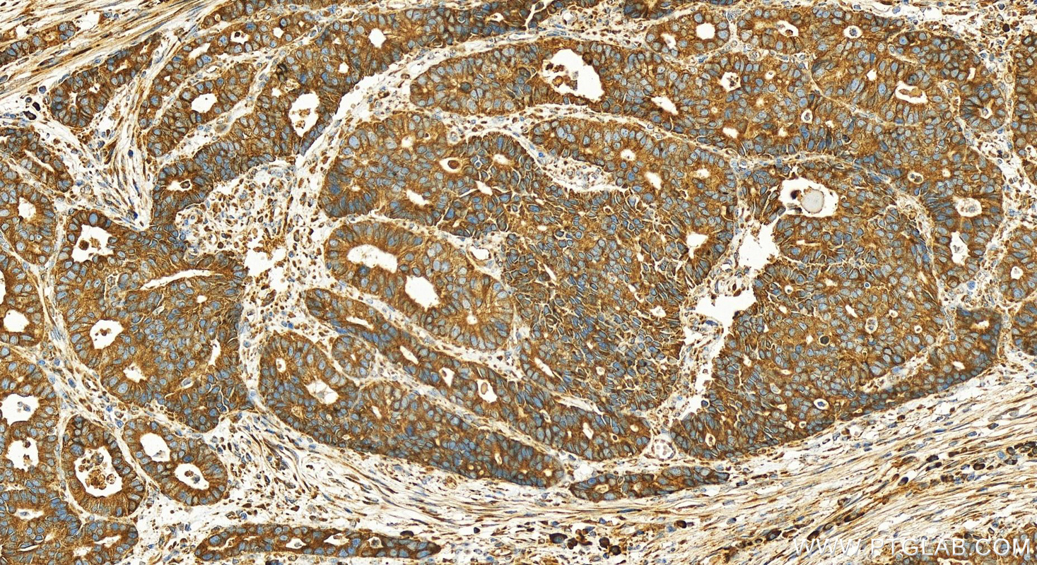 IHC staining of human stomach using 10958-1-AP