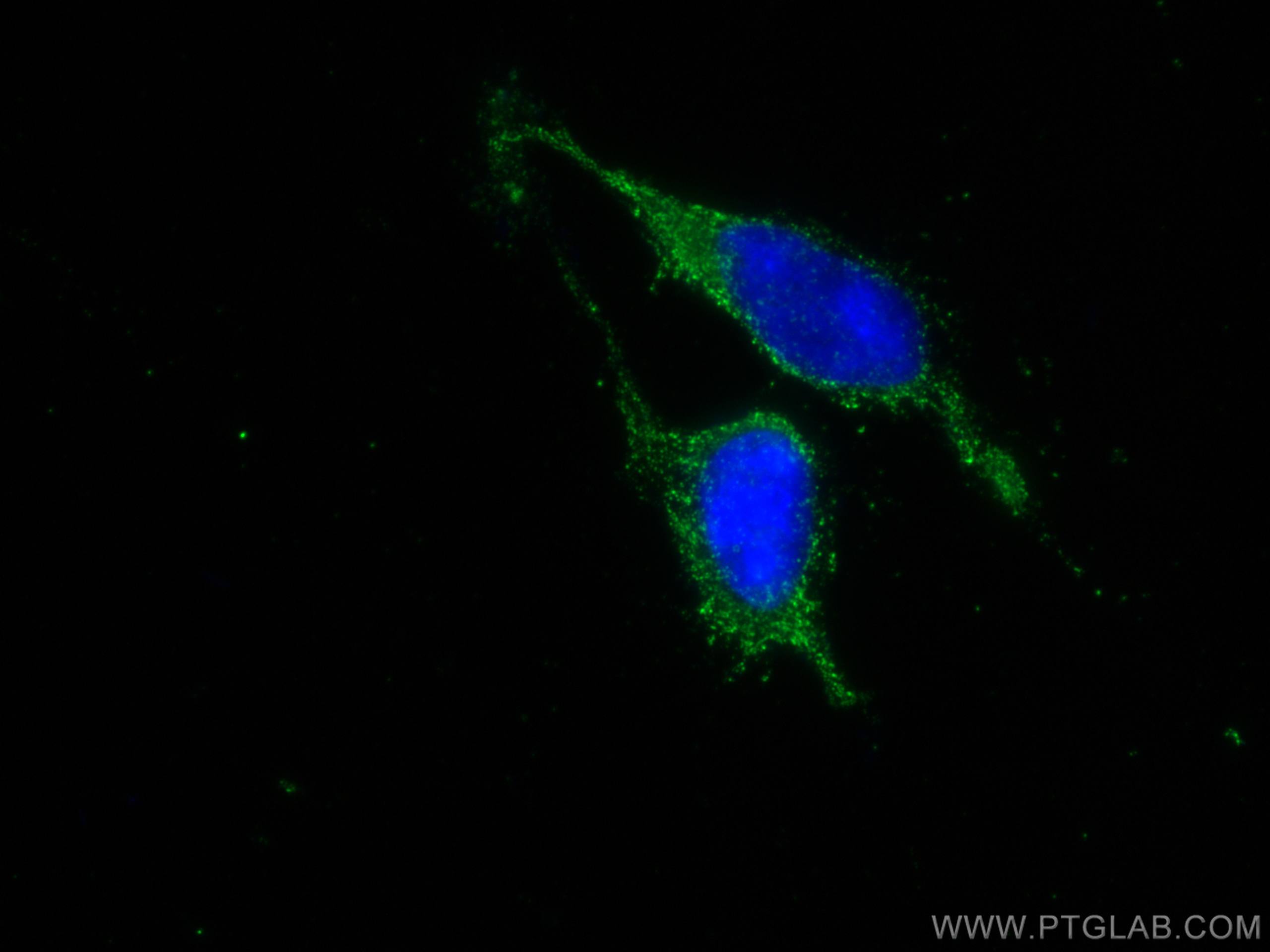 IF Staining of HEK-293 using 67441-1-Ig (same clone as 67441-1-PBS)