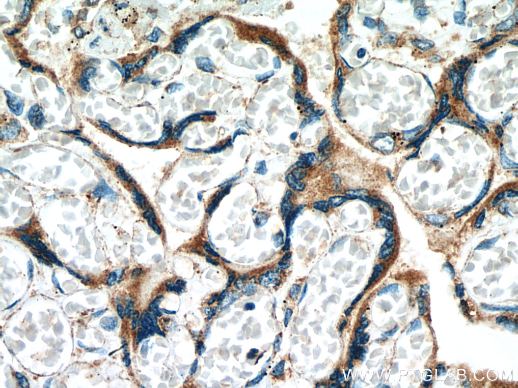 IHC staining of human placenta using 67441-1-Ig (same clone as 67441-1-PBS)