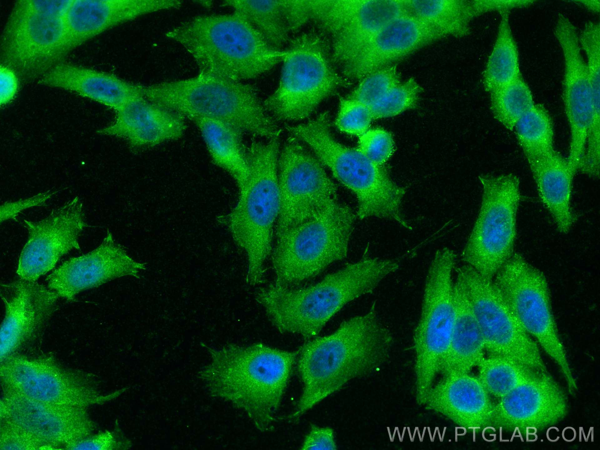 IF Staining of HepG2 using 25869-1-AP