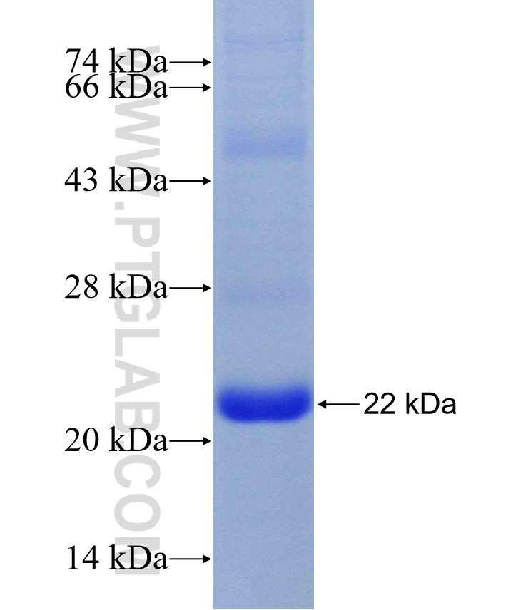 METAP1 fusion protein Ag29828 SDS-PAGE