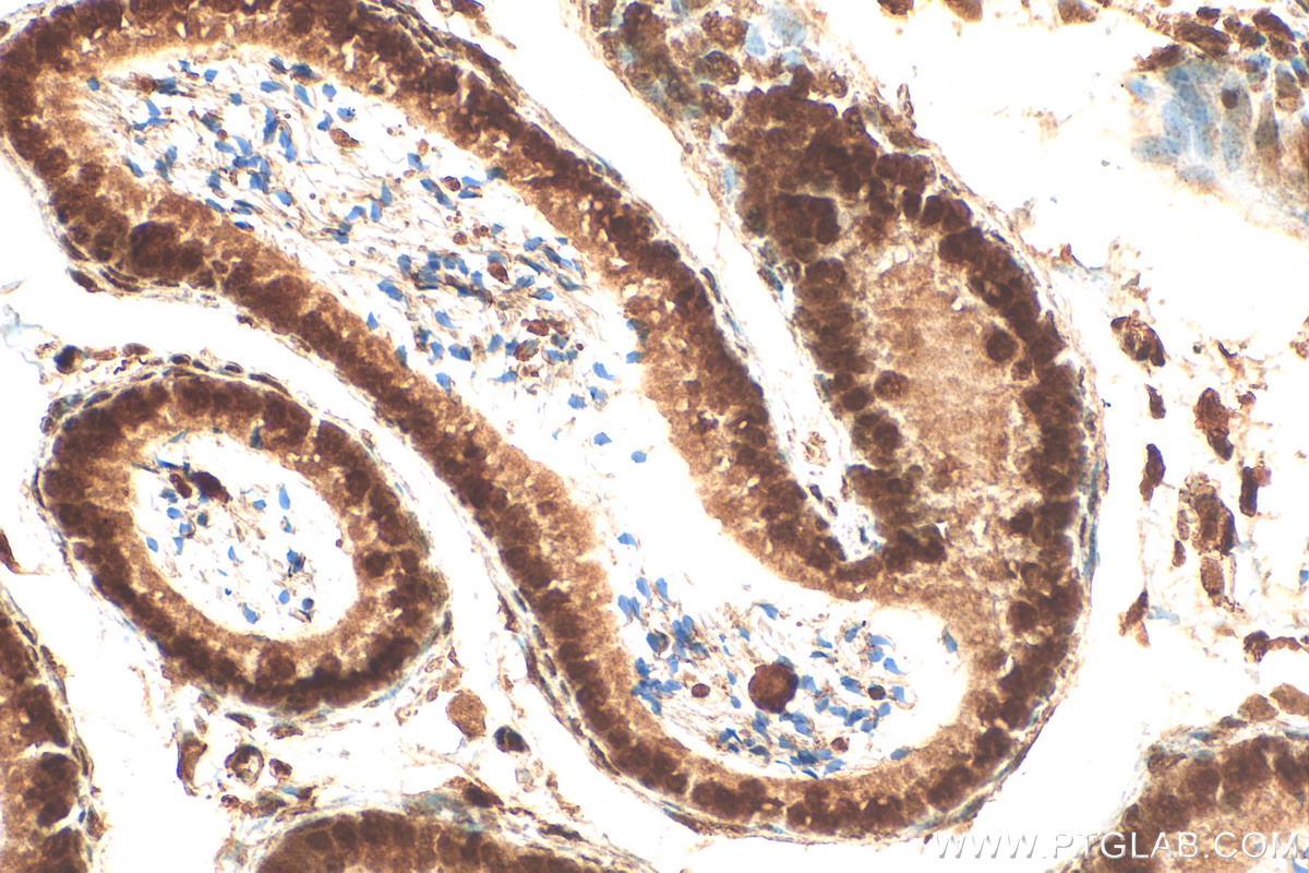 IHC staining of mouse testis using 19924-1-AP